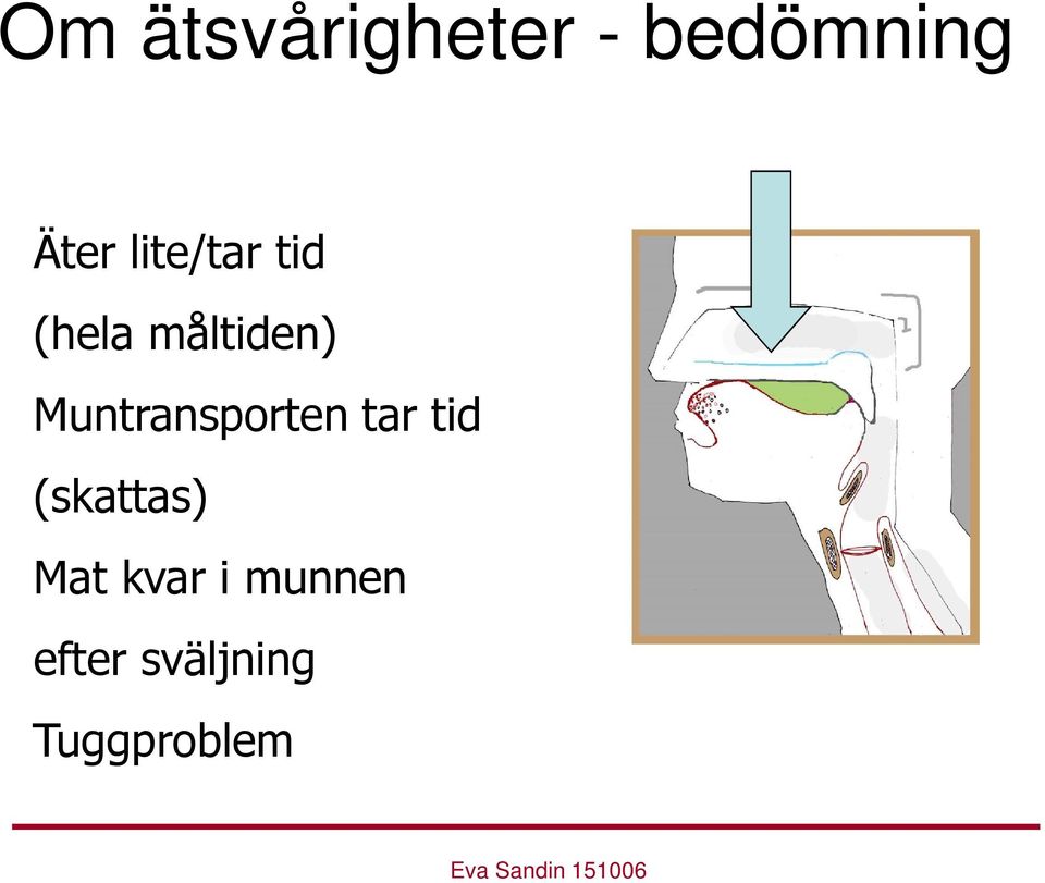 Muntransporten tar tid (skattas)
