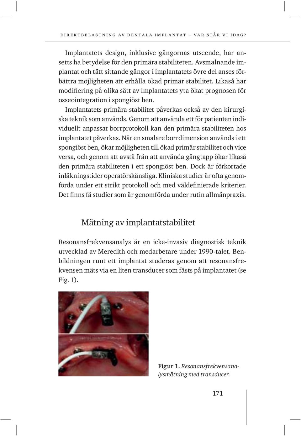 Likaså har modifiering på olika sätt av implantatets yta ökat prognosen för osseointegration i spongiöst ben. Implantatets primära stabilitet påverkas också av den kirurgiska teknik som används.