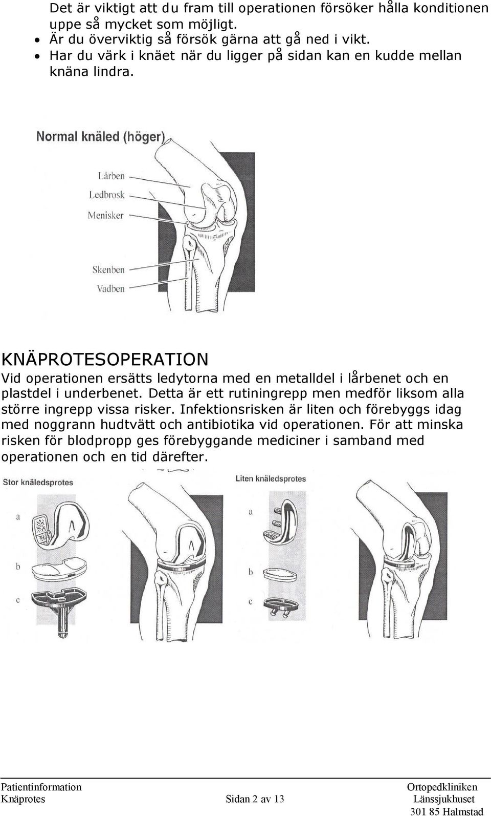 KNÄPROTESOPERATION Vid operationen ersätts ledytorna med en metalldel i lårbenet och en plastdel i underbenet.