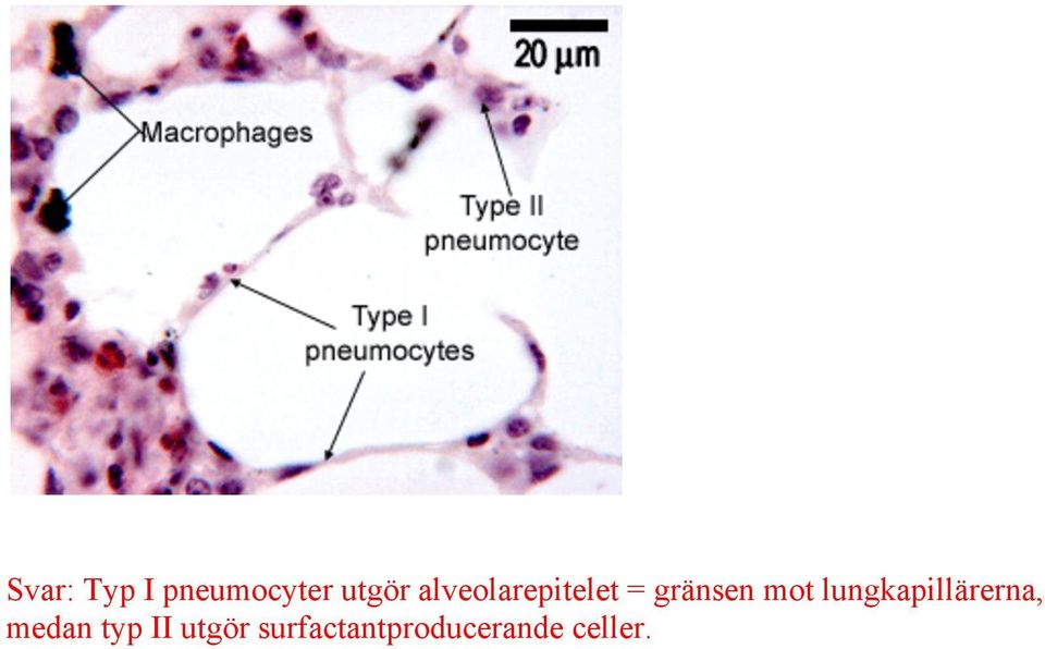 lungkapillärerna, medan typ II