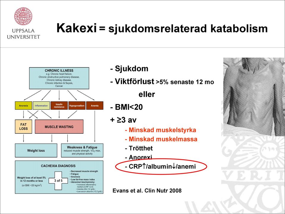 Minskad muskelstyrka - Minskad muskelmassa - Trötthet