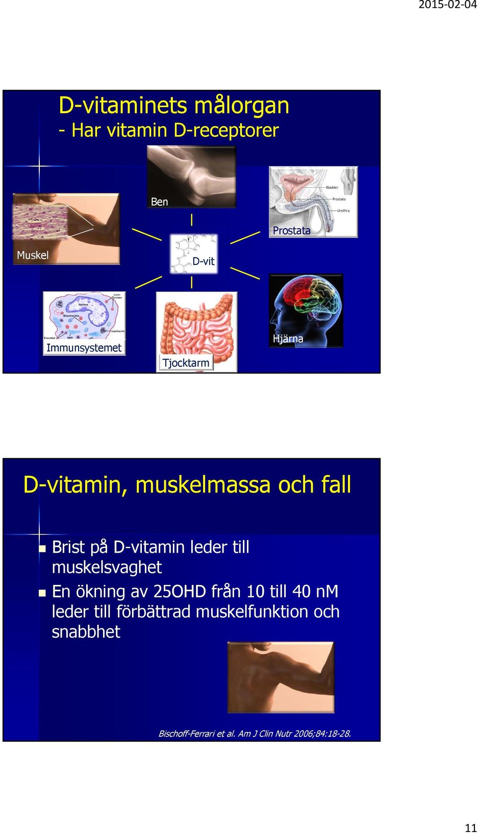 leder till muskelsvaghet En ökning av 25OHD från 10 till 40 nm leder till