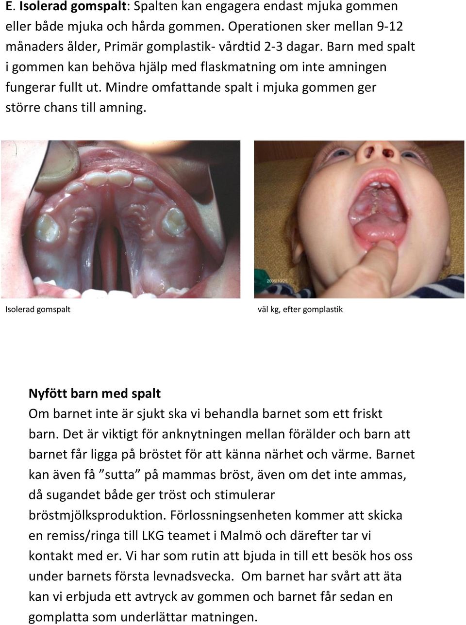 Isolerad gomspalt väl kg, efter gomplastik Nyfött barn med spalt Om barnet inte är sjukt ska vi behandla barnet som ett friskt barn.