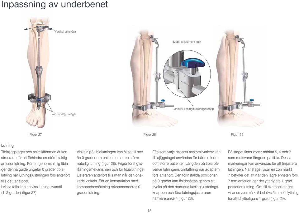 I vissa falla kan en viss lutning kvarstå (1 2 grader) (figur 27). Vinkeln på tibialutningen kan ökas till mer än 0 grader om patienten har en större naturlig lutning (figur 28).