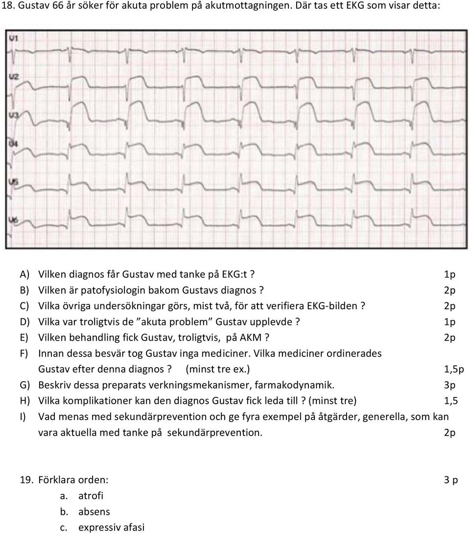 F) Innan dessa besvär tog Gustav inga med iciner. Vilka mediciner ordinerades Gustav efter denna diagnos? (minst tre ex.) 1,5p G) Beskriv dessa preparats verkningsmekanismer, farmakodynamik.