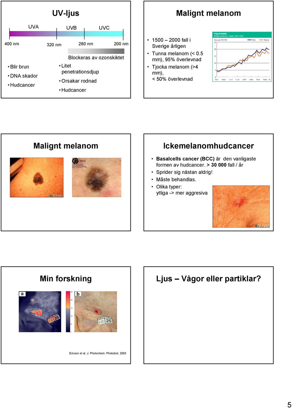 5 mm), 95% överlevnad Tjocka melanom (>4 mm), < 50% överlevnad Malignt melanom Ickemelanomhudcancer Basalcells cancer (BCC) är den vanligaste formen