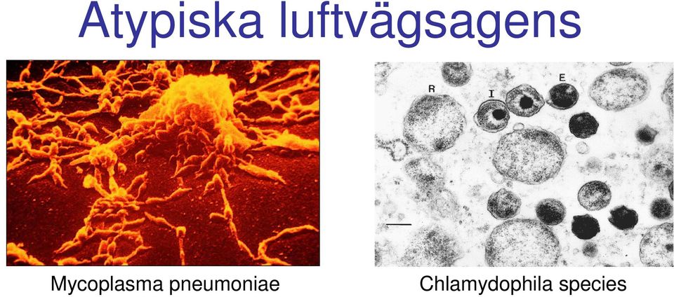 Mycoplasma