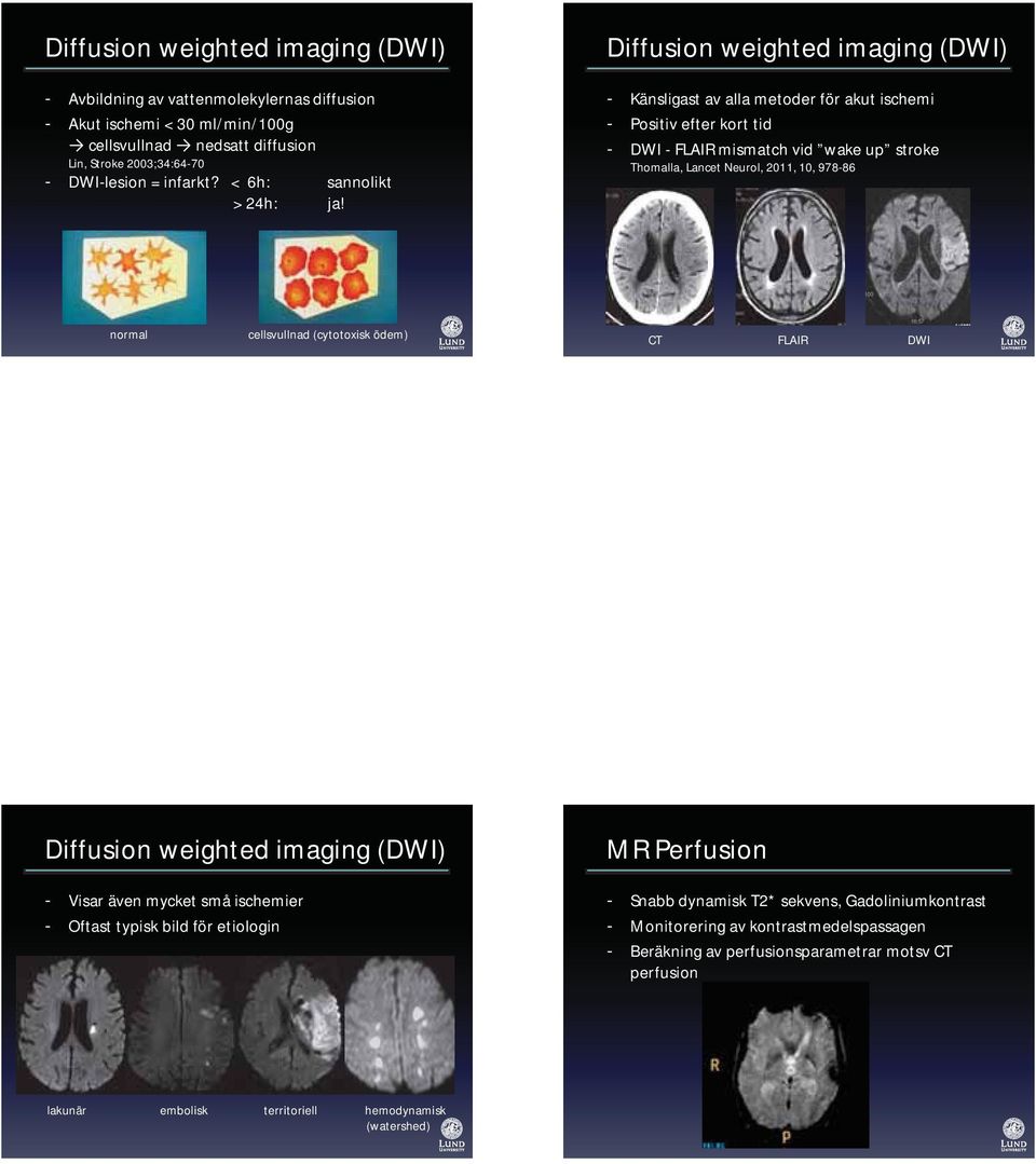 Diffusion weighted imaging (DWI) - Känsligast av alla metoder för akut ischemi - Positiv efter kort tid - DWI - FLAIR mismatch vid wake up stroke Thomalla, Lancet Neurol, 2011, 10, 978-86