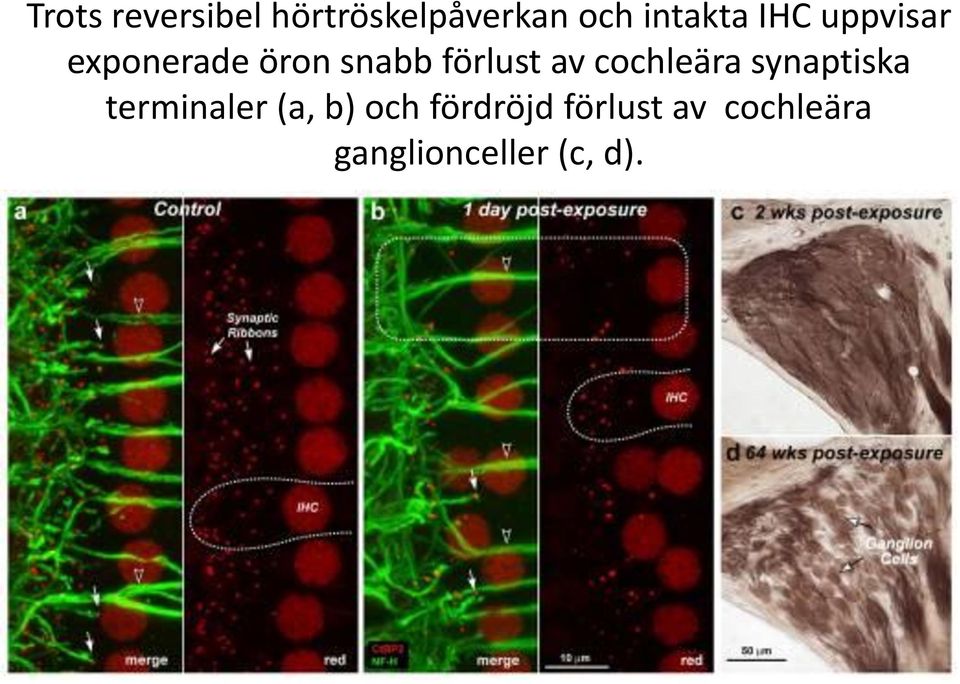 cochleära synaptiska terminaler (a, b) och