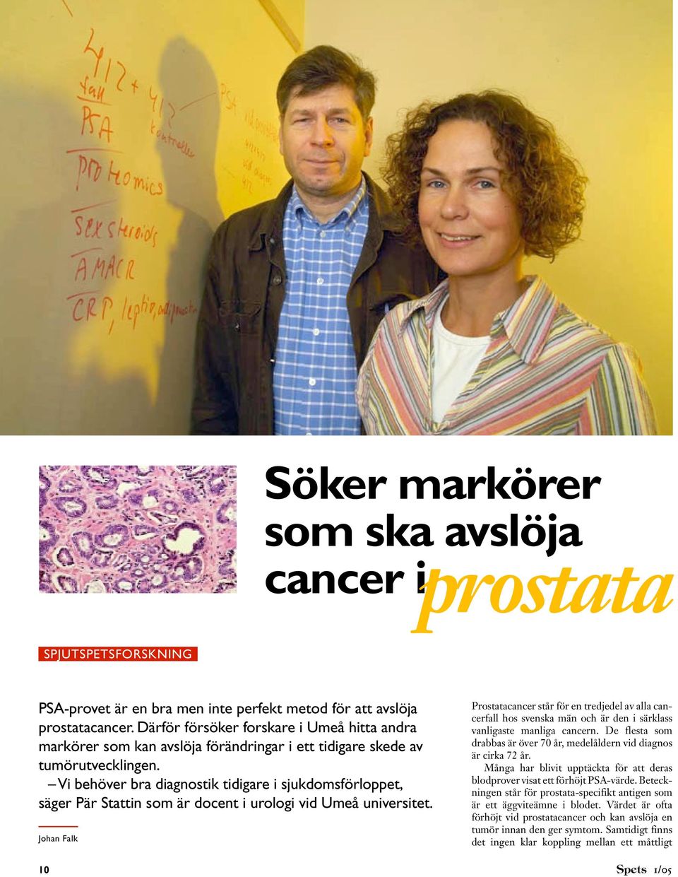 Vi behöver bra diagnostik tidigare i sjukdomsförloppet, säger Pär Stattin som är docent i urologi vid Umeå universitet.