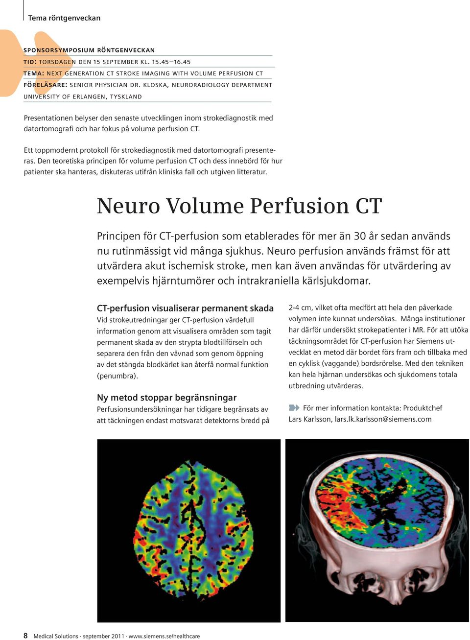 Ett toppmodernt protokoll för strokediagnostik med datortomografi presenteras.