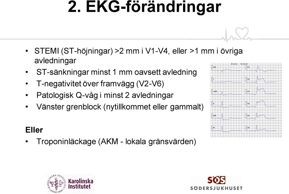 över framvägg (V2-V6) Patologisk Q-våg i minst 2 avledningar Vänster