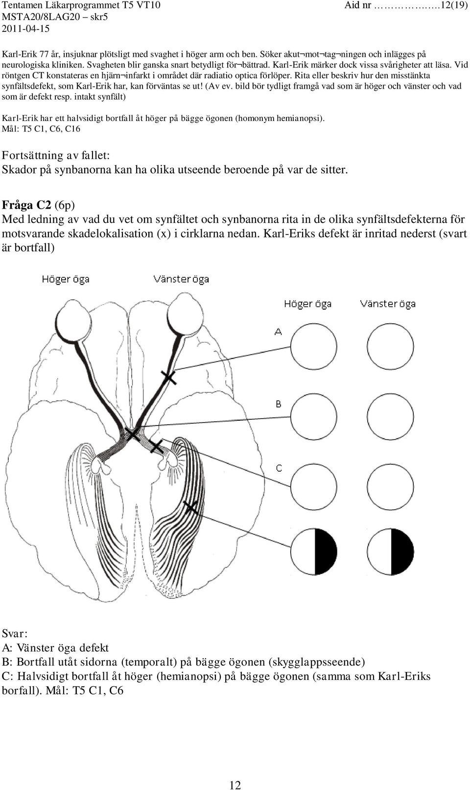 Rita eller beskriv hur den misstänkta synfältsdefekt, som Karl-Erik har, kan förväntas se ut! (Av ev. bild bör tydligt framgå vad som är höger och vänster och vad som är defekt resp.