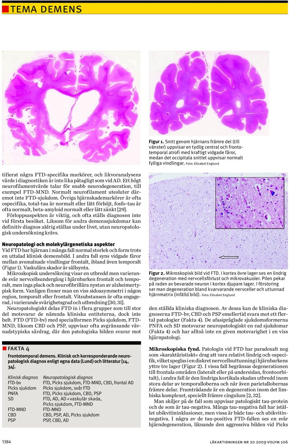 Foto: Elisabet Englund tifierat några FTD-specifika markörer, och likvoranalysens värde i diagnostiken är inte lika påtagligt som vid AD.