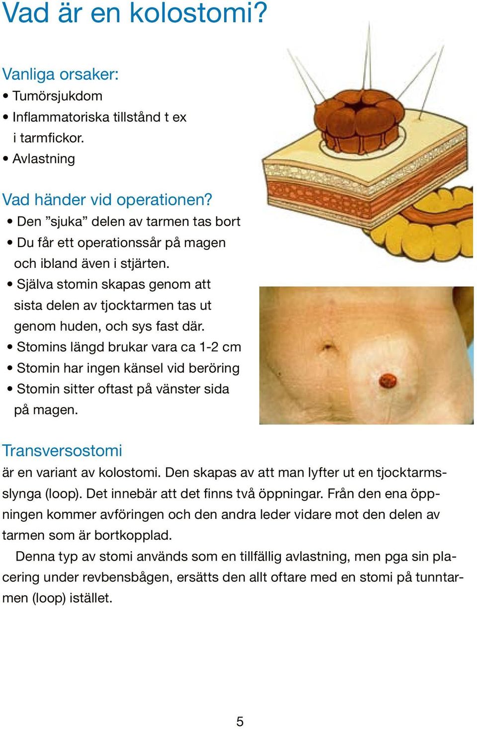 Stomins längd brukar vara ca 1-2 cm Stomin har ingen känsel vid beröring Stomin sitter oftast på vänster sida på magen. Transversostomi är en variant av kolostomi.