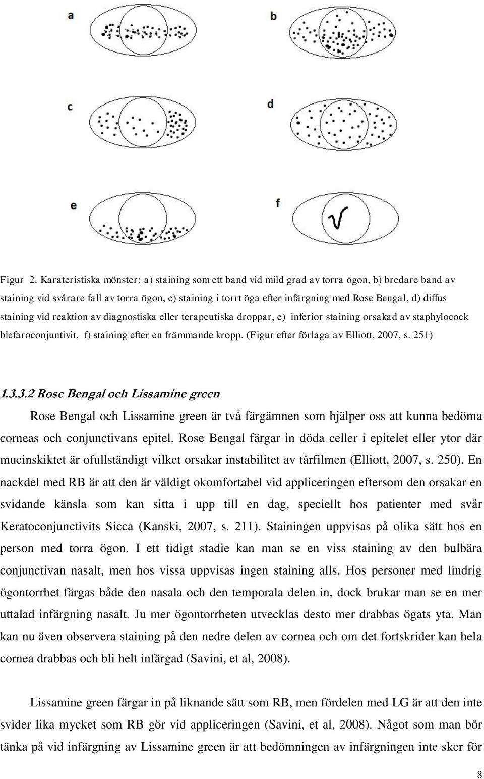 diffus staining vid reaktion av diagnostiska eller terapeutiska droppar, e) inferior staining orsakad av staphylocock blefaroconjuntivit, f) staining efter en främmande kropp.