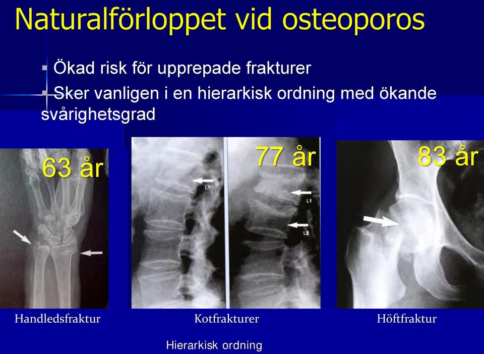 svårighetsgrad 63 år 77 år 83 år