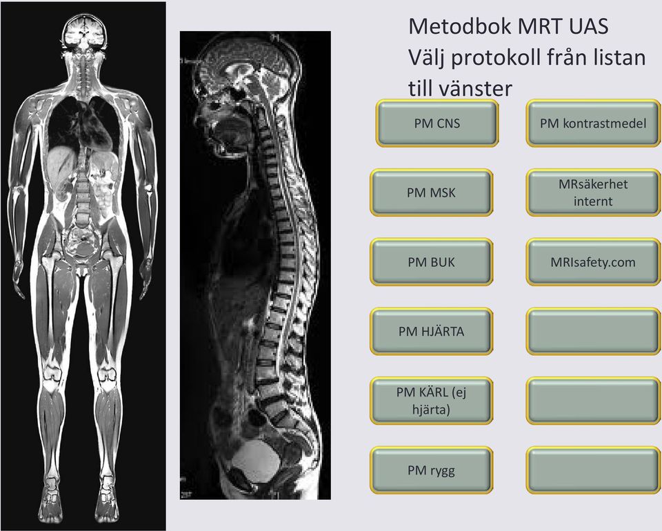 kontrastmedel PM MSK MRsäkerhet internt