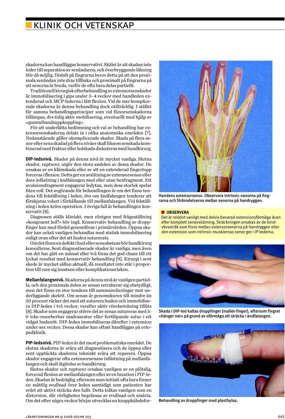 Traditionell kirurgisk efterbehandling av extensorsenskador är immobilisering i gips under 3 4 veckor med handleden extenderad och MCP-lederna i lätt flexion.