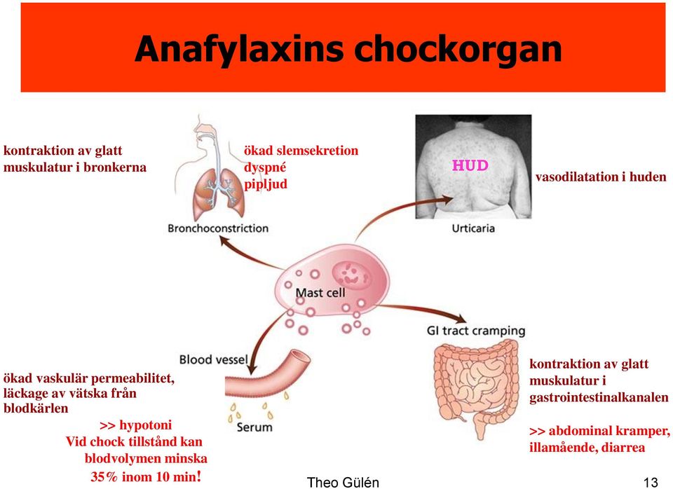 blodkärlen >> hypotoni Vid chock tillstånd kan blodvolymen minska 35% inom 10 min!