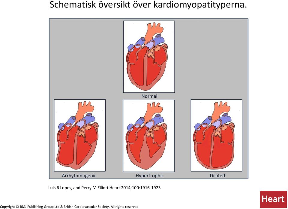 2014;100:1916-1923 Copyright BMJ Publishing