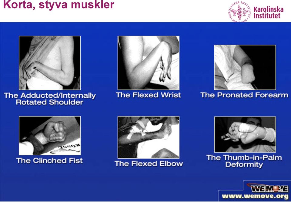 muskler