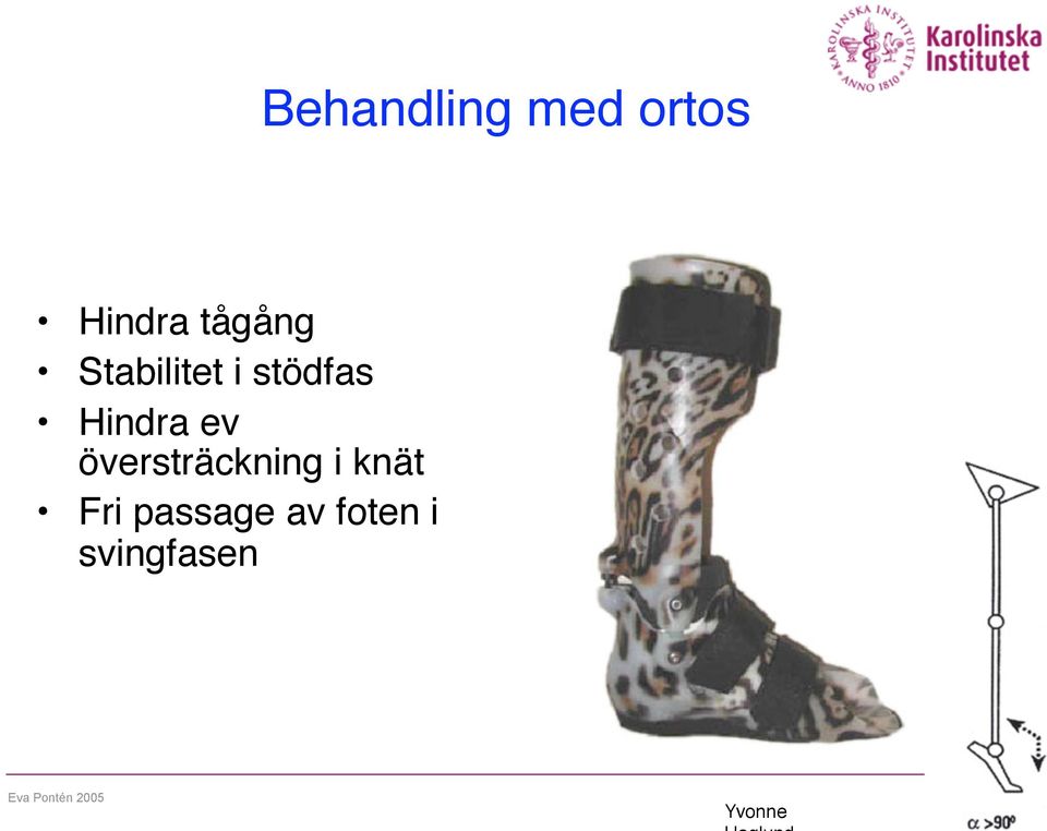 översträckning i knät Fri passage