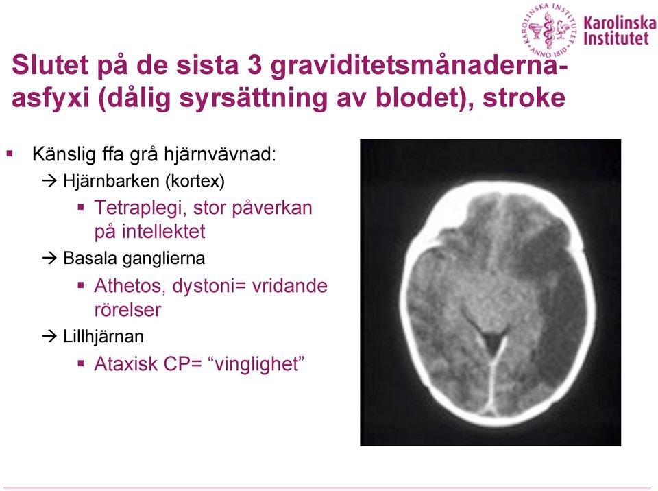 (kortex) Tetraplegi, stor påverkan på intellektet Basala