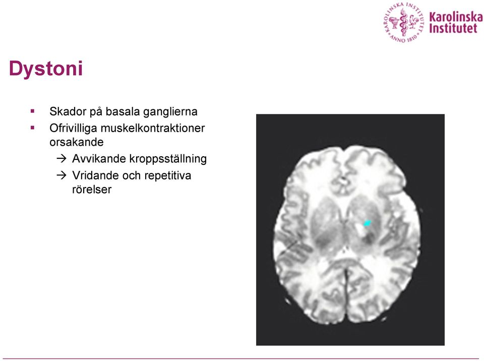 muskelkontraktioner orsakande