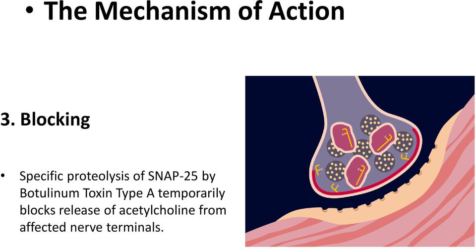 by Botulinum Toxin Type A temporarily