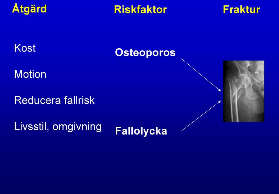 Reducera fallrisk