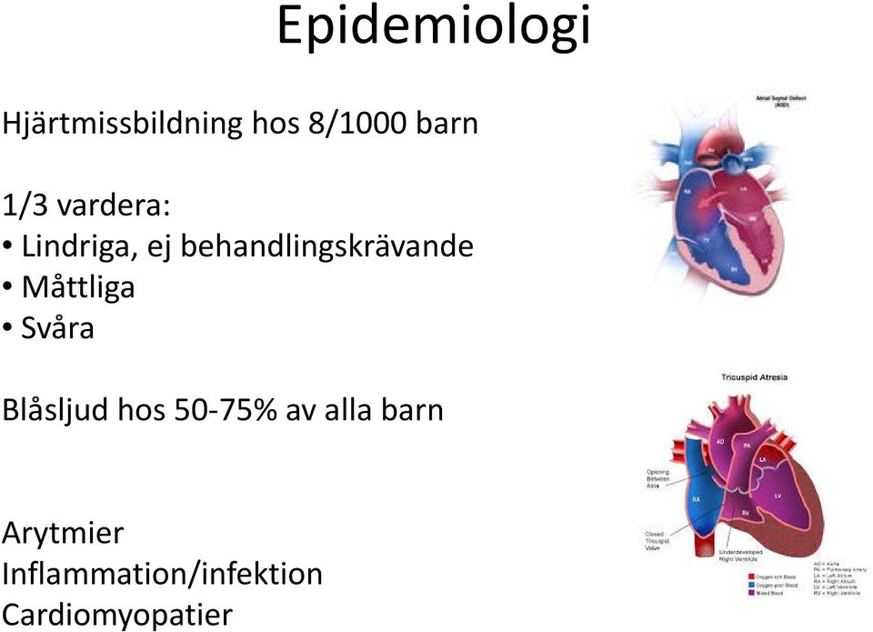 Måttliga Svåra Blåsljud hos 50-75% av alla