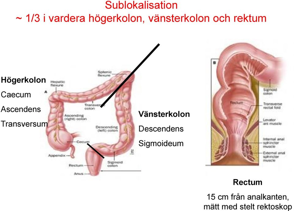 Ascendens Transversum Vänsterkolon Descendens