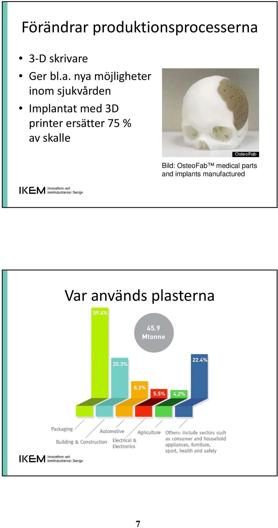 printer ersätter 75 % av skalle Bild: OsteoFab