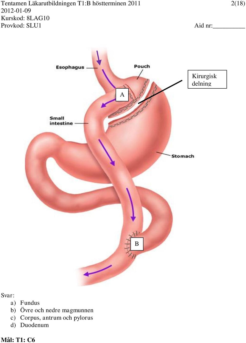 B Svar: a) Fundus b) Övre och nedre