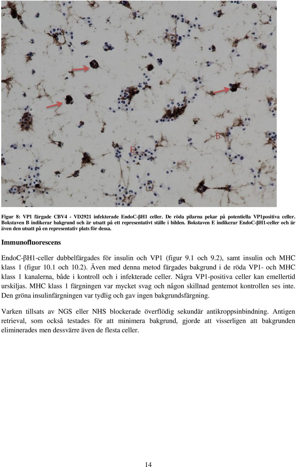 Immunofluorescens EndoC-βH1-celler dubbelfärgades för insulin och VP1 (figur 9.1 och 9.2),