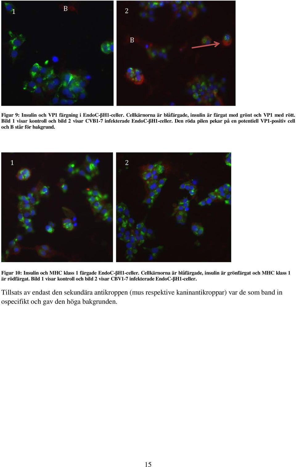 1 2 Figur 10: Insulin och MHC klass 1 färgade EndoC-βH1-celler. Cellkärnorna är blåfärgade, insulin är grönfärgat och MHC klass 1 är rödfärgat.