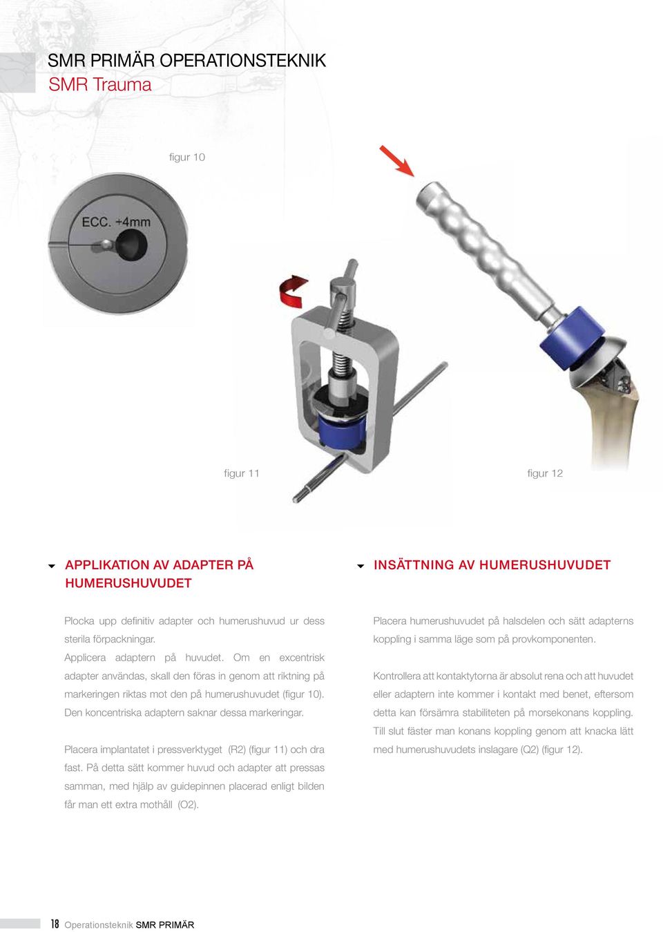 Om en excentrisk adapter användas, skall den föras in genom att riktning på markeringen riktas mot den på humerushuvudet (figur 10). Den koncentriska adaptern saknar dessa markeringar.