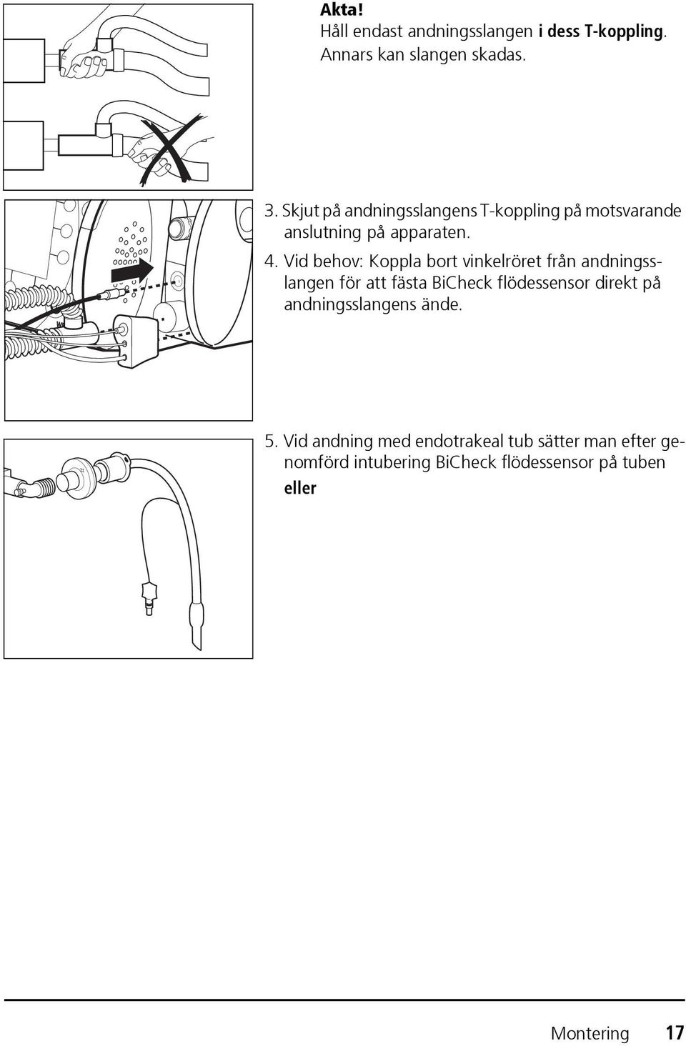 Vid behov: Koppla bort vinkelröret från andningsslangen för att fästa BiCheck flödessensor direkt på