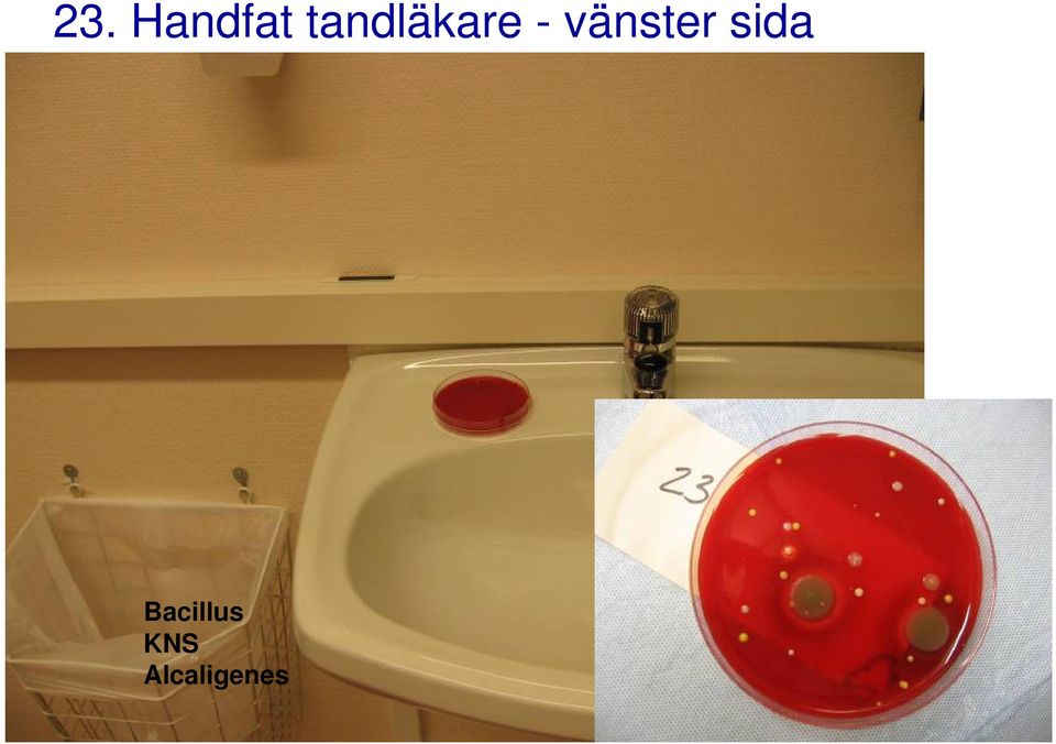 vänster sida