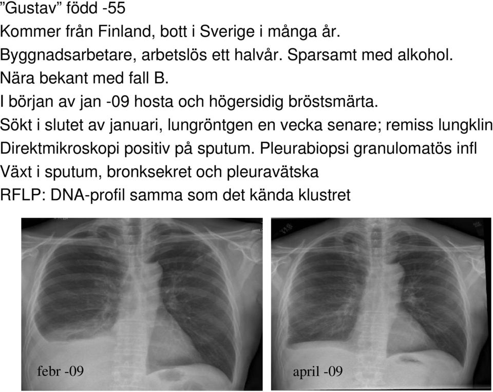 Sökt i slutet av januari, lungröntgen en vecka senare; remiss lungklin Direktmikroskopi positiv på sputum.