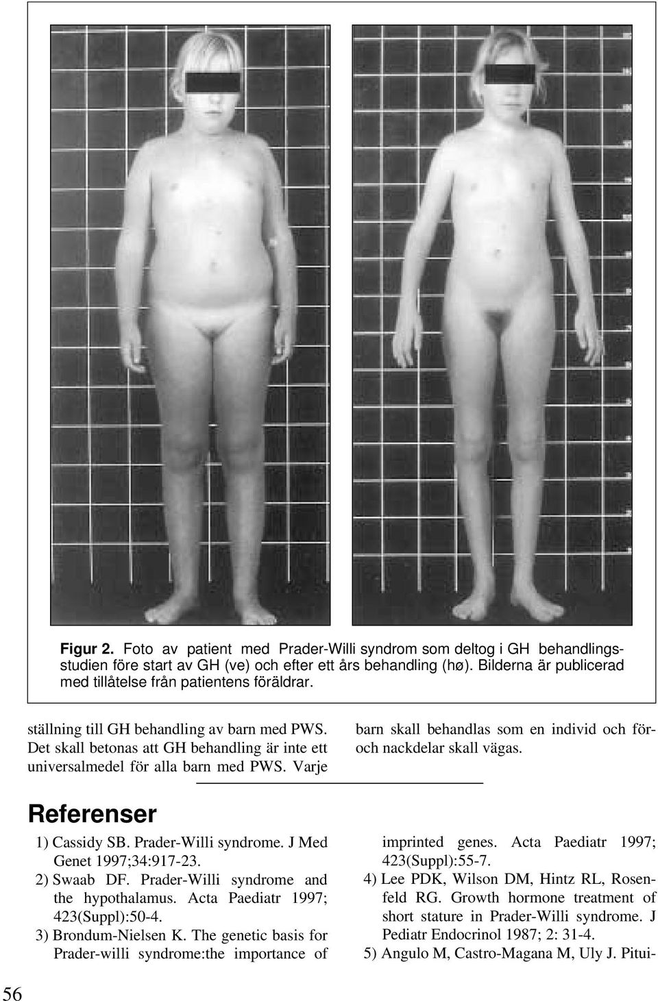 Varje Referenser 1) Cassidy SB. Prader-Willi syndrome. J Med Genet 1997;34:917-23. 2) Swaab DF. Prader-Willi syndrome and the hypothalamus. Acta Paediatr 1997; 423(Suppl):50-4. 3) Brondum-Nielsen K.