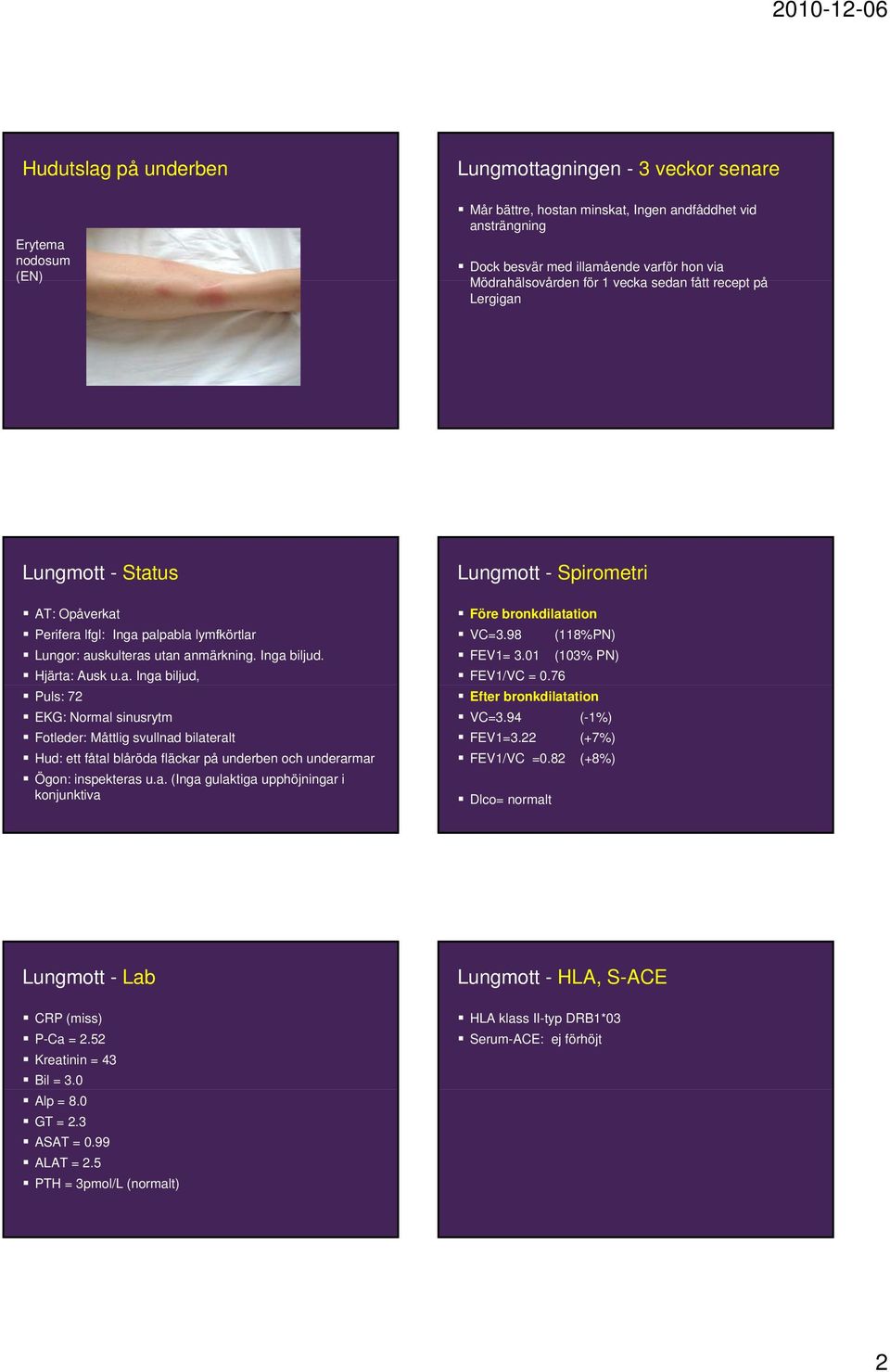 a. (Inga gulaktiga upphöjningar i konjunktiva Lungmott - Spirometri Före bronkdilatation VC=3.98 (118%PN) FEV1= 3.01 (103% PN) FEV1/VC = 0.76 Efter bronkdilatation VC=3.94 (-1%) FEV1=3.