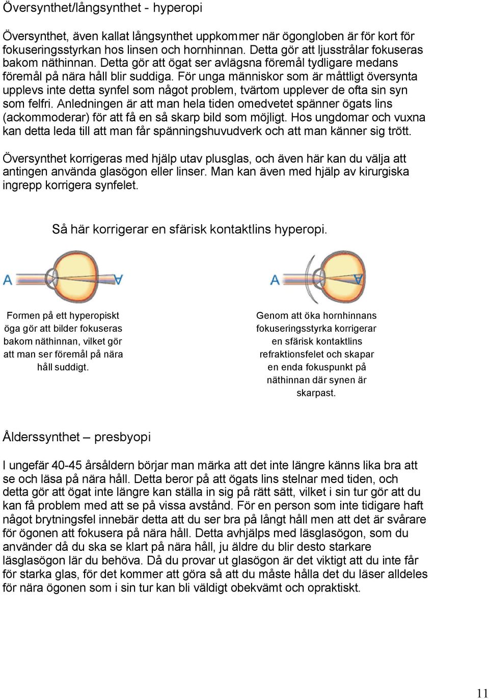 För unga människor som är måttligt översynta upplevs inte detta synfel som något problem, tvärtom upplever de ofta sin syn som felfri.