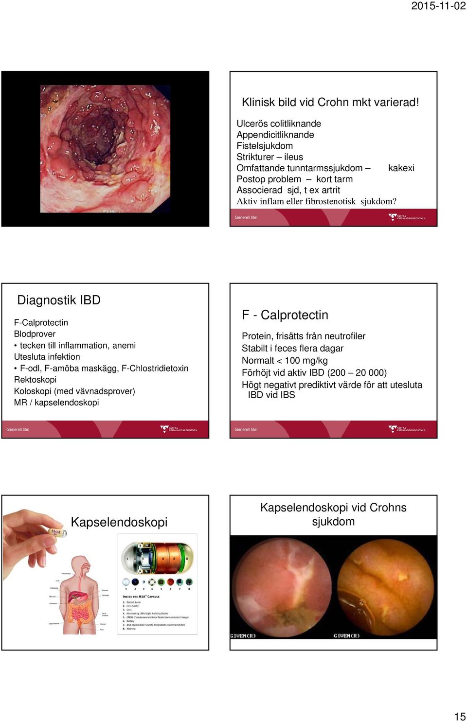 inflam eller fibrostenotisk sjukdom?