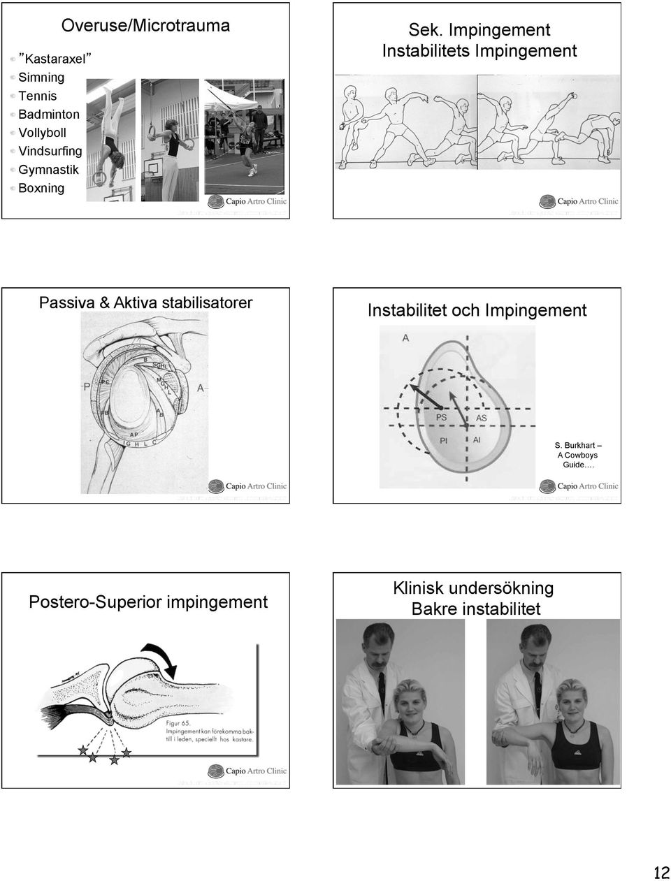 Impingement Instabilitets Impingement Passiva & Aktiva stabilisatorer