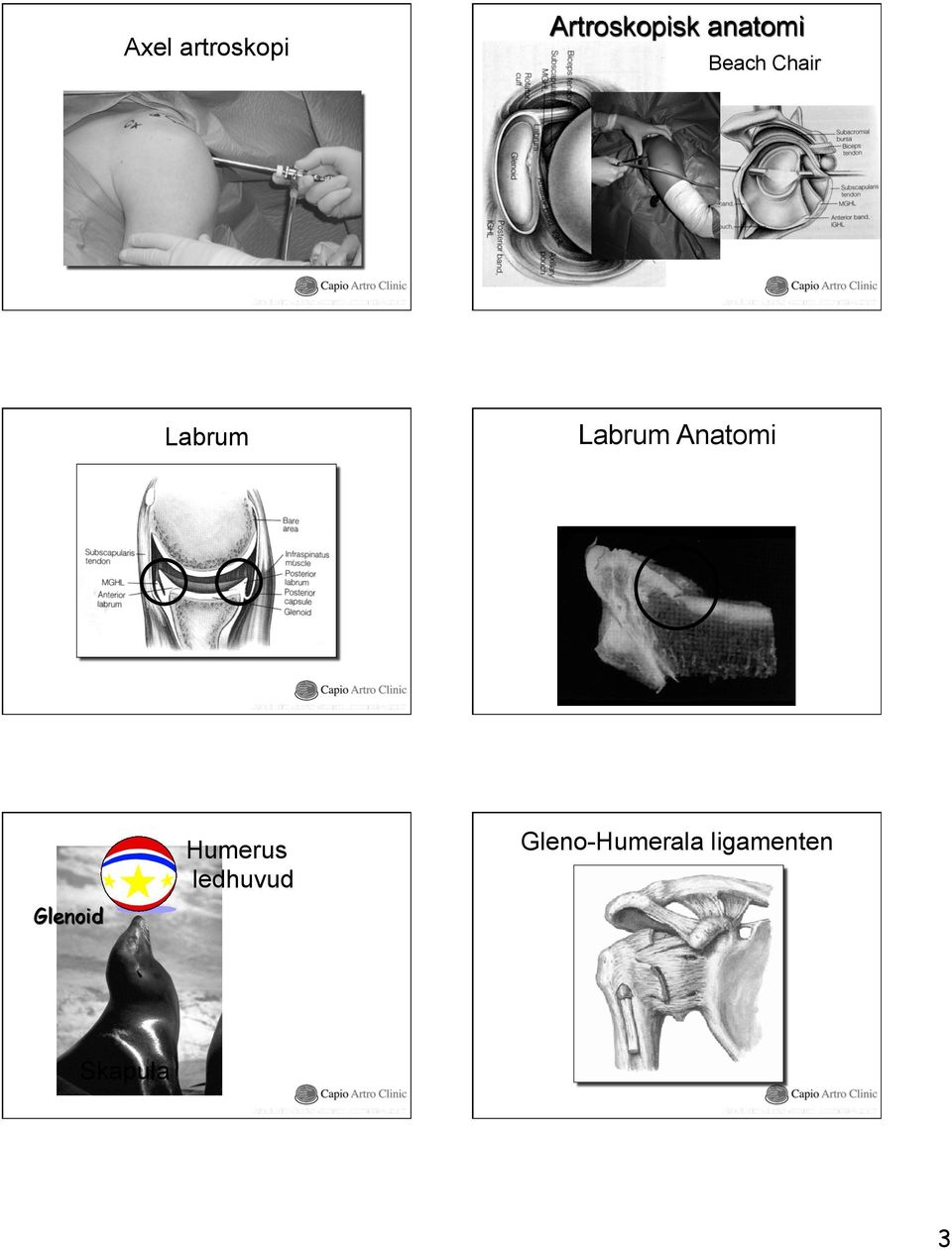 Anatomi Inferior Glenoid Humerus