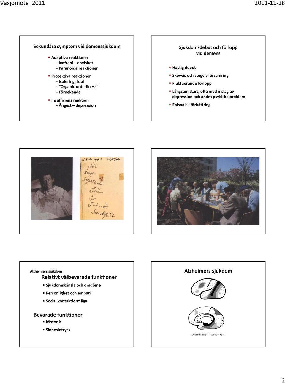 Fluktuerande förlopp Långsam start, oua med inslag av depression och andra psykiska problem Episodisk förbä0ring Alzheimers sjukdom Rela<vt välbevarade