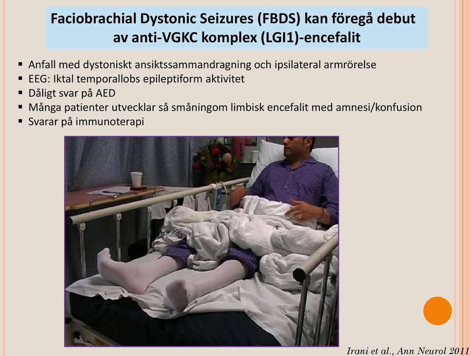 komplex (LGI1)-encefalit Anfall med dystoniskt ansiktssammandragning och ipsilateral