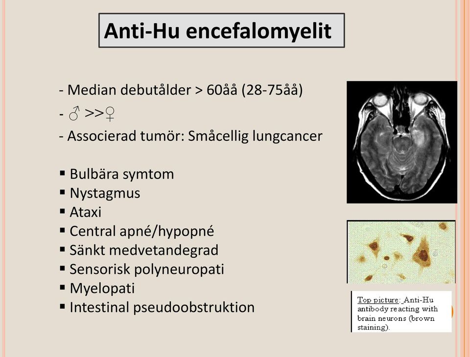 Nystagmus Ataxi Central apné/hypopné Sänkt medvetandegrad